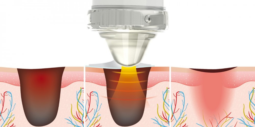 c6c3d54d0af7a2f1bd466b766859529d_1761017143_7794.jpg c6c3d54d0af7a2f1bd466b766859529d_1761017143_7794.jpg